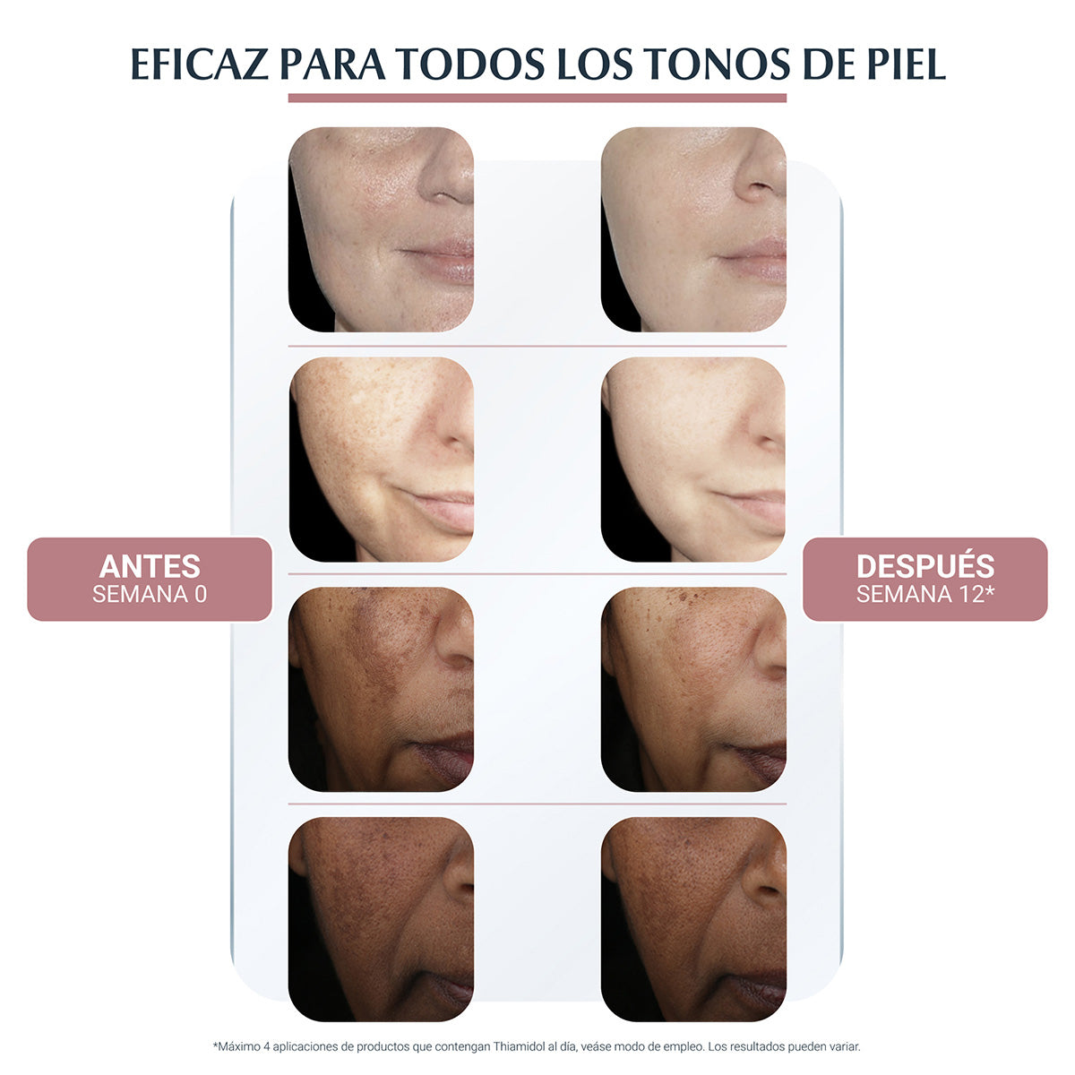 Eucerin - Anti-Pigment Crema Facial de Día Anti-Hiperpigmentación FPS30 – 50 ml.