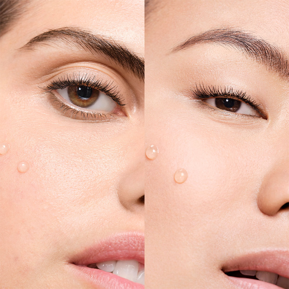 Vichy - Normaderm Probio BHA Sérum - 30 ml.