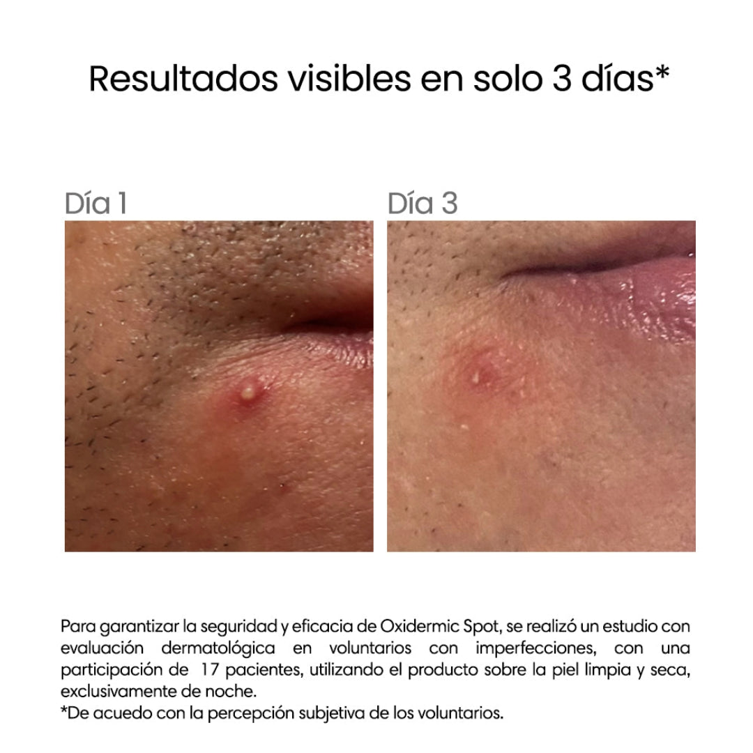 Revé – Oxidermic Spot Gel – 5 g.