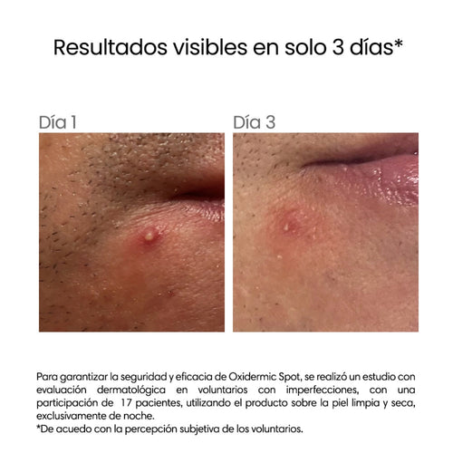 Revé – Oxidermic Spot Gel – 5 g.