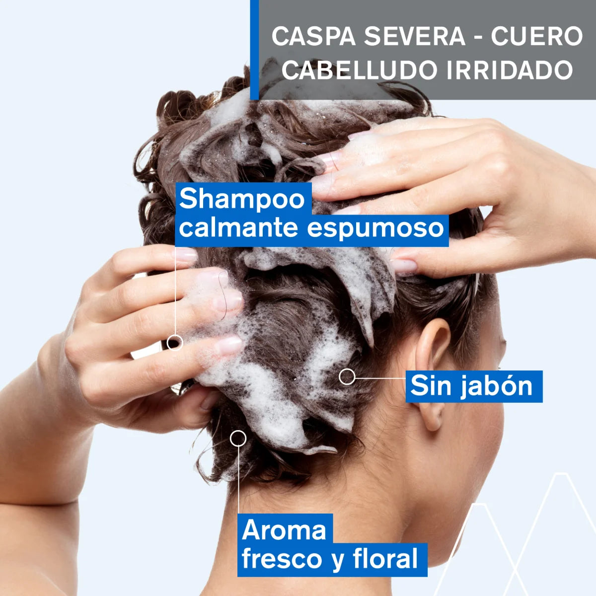 Uriage - DS Shampoo Anticaspa Severa Con Ácido Láctico – 150 ml.