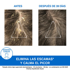 Uriage - DS Shampoo Anticaspa Severa Con Ácido Láctico – 150 ml.