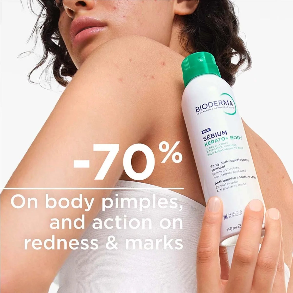 Bioderma – Sebium Kerato + Body Spray – 150 ml.