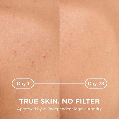 Bioderma – Sebium Kerato + Body Spray – 150 ml.