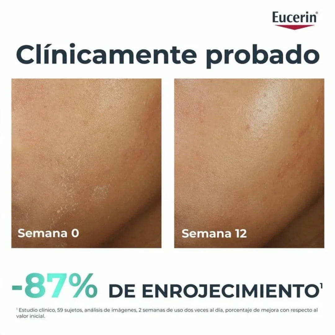 Eucerin – Dermopure Clinical Hydra Repair Crema Calmante – 40 ml.