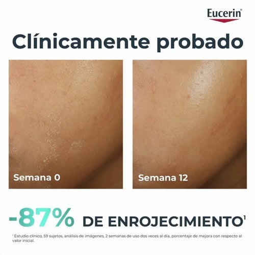 Eucerin – Dermopure Clinical Hydra Repair Crema Calmante – 40 ml.