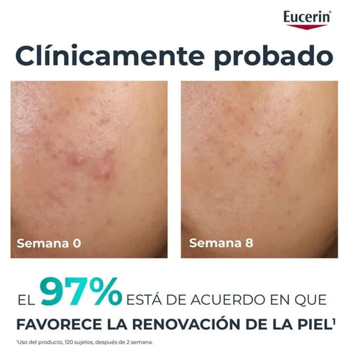 Eucerin – Dermopure Clinical Peeling 10 Crema de noche – 40 ml.