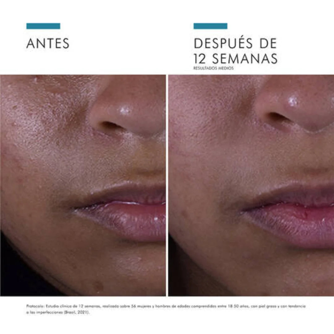 SkinCeuticals – Silymarin CF – 30 ml.