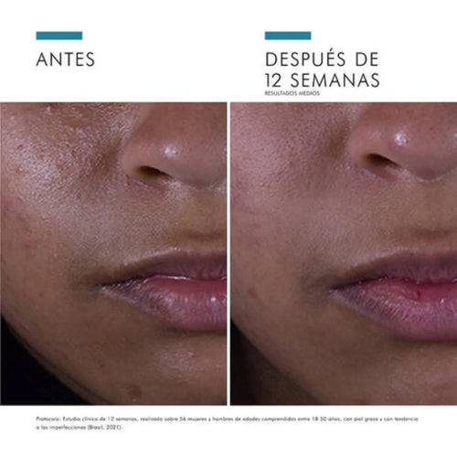 SkinCeuticals – Silymarin CF – 30 ml.