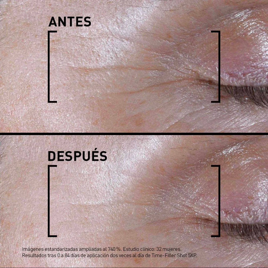 Filorga – Time-Filler Shot 5xp Suero Concentrado – 15 ml.