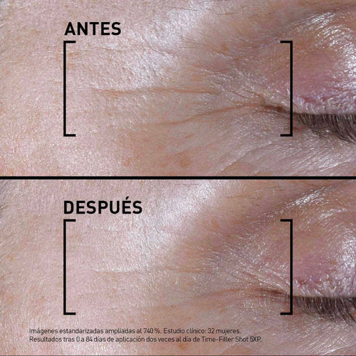 Filorga – Time-Filler Shot 5xp Suero Concentrado – 15 ml.