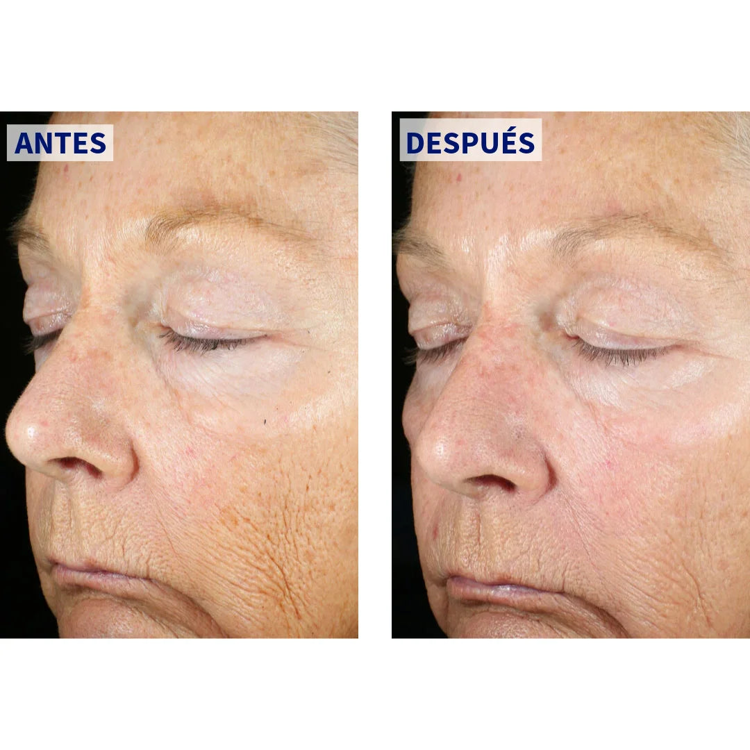 ZO Skin Health – Wrinkle + Texture – 50 ml.