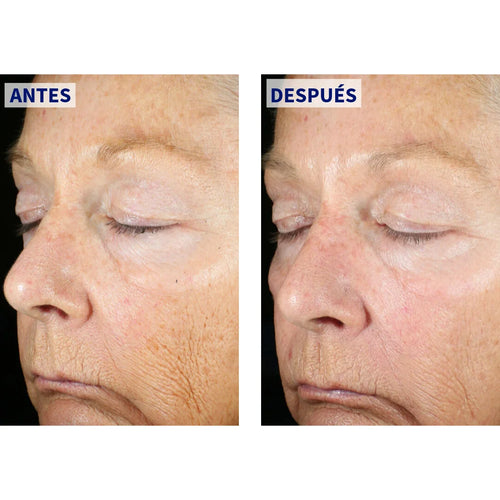 ZO Skin Health – Wrinkle + Texture – 50 ml.