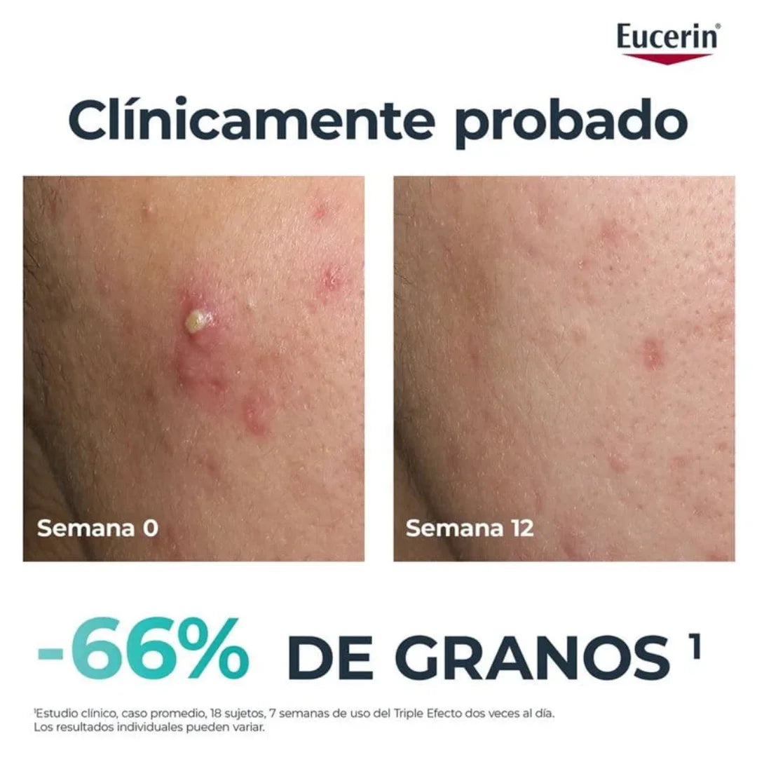 Eucerin – Dermopure Clinical Triple Action Serum Corrector – 40 ml.