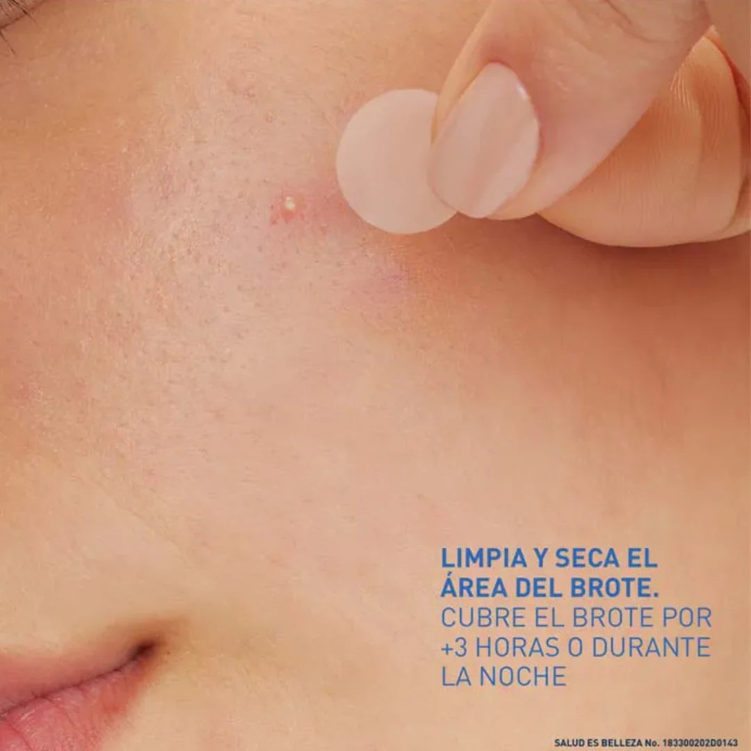 CeraVe – Parches Control Imperfecciones – 22 parches