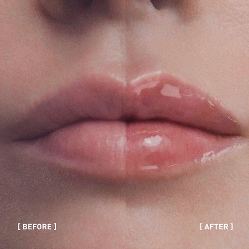 Filorga – Hyalu-Filler Lips – 4 g.