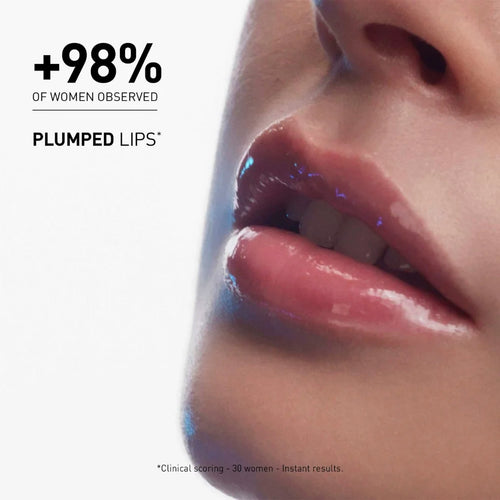 Filorga – Hyalu-Filler Lips – 4 g.